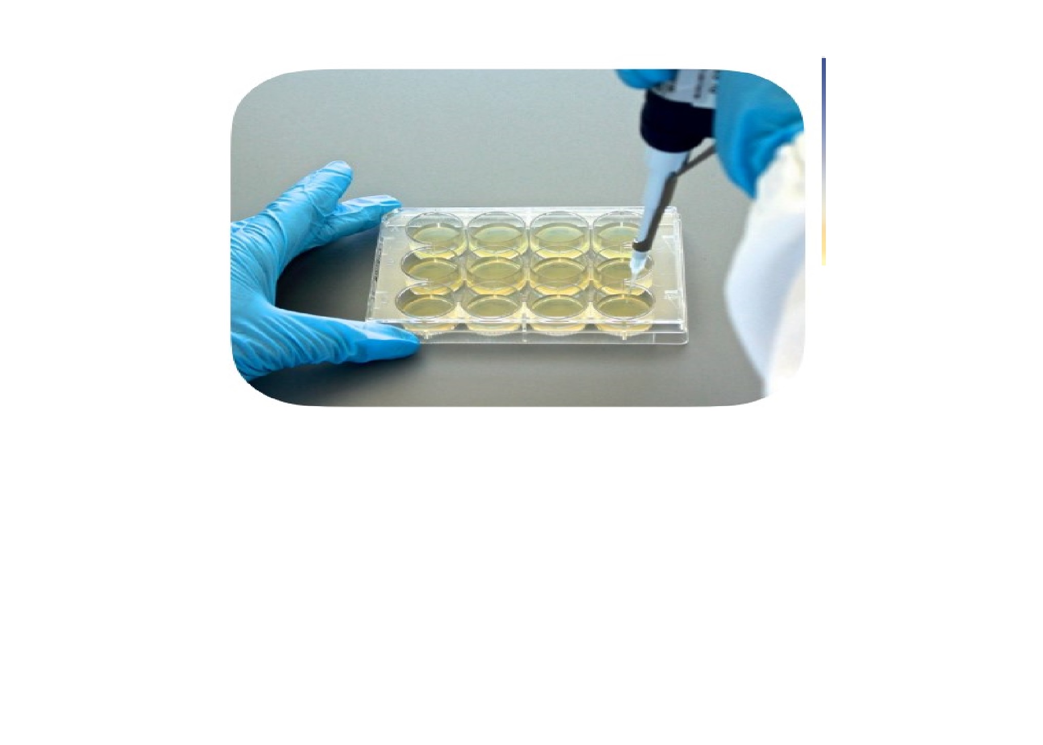 Antimicrobial Susceptibility Testing